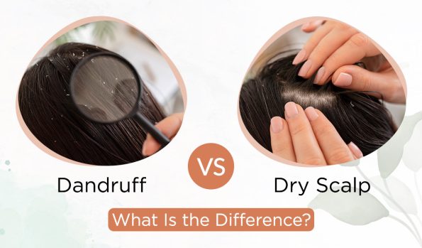 Dandruff Vs Dry Scalp What Is The Difference The Indie Earth