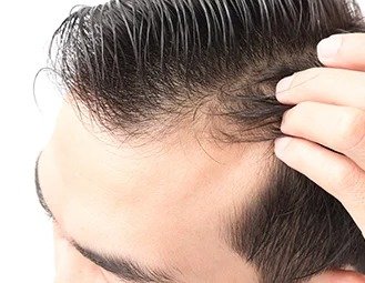 Prepare Your Scalp